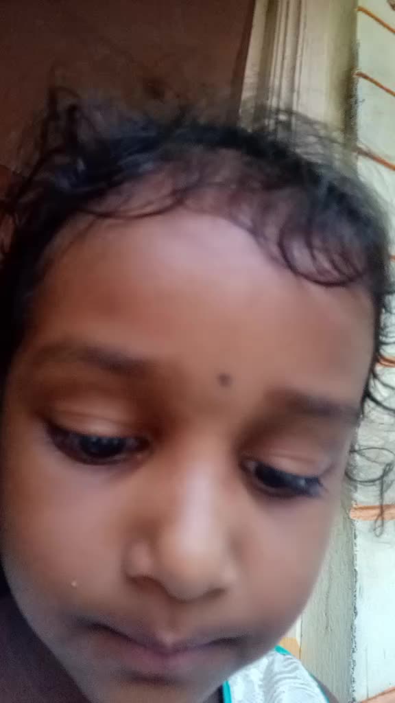 @Yakob Nallipogu