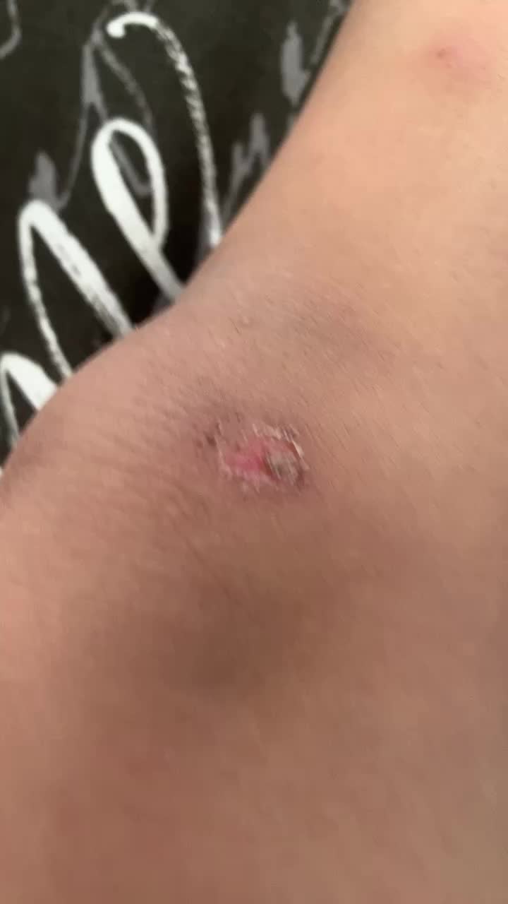 @Angelo10102015