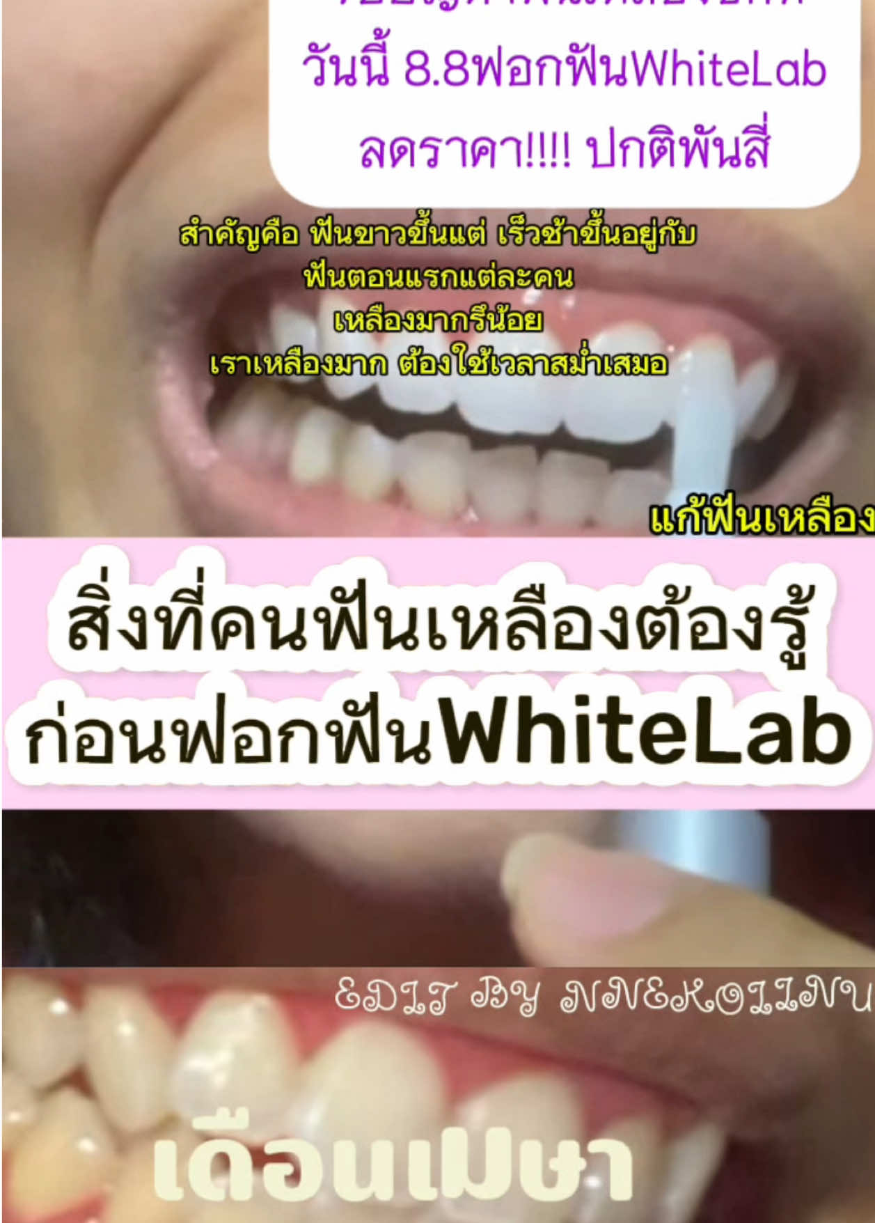 @NNEkOIINUใช้แล้วดี