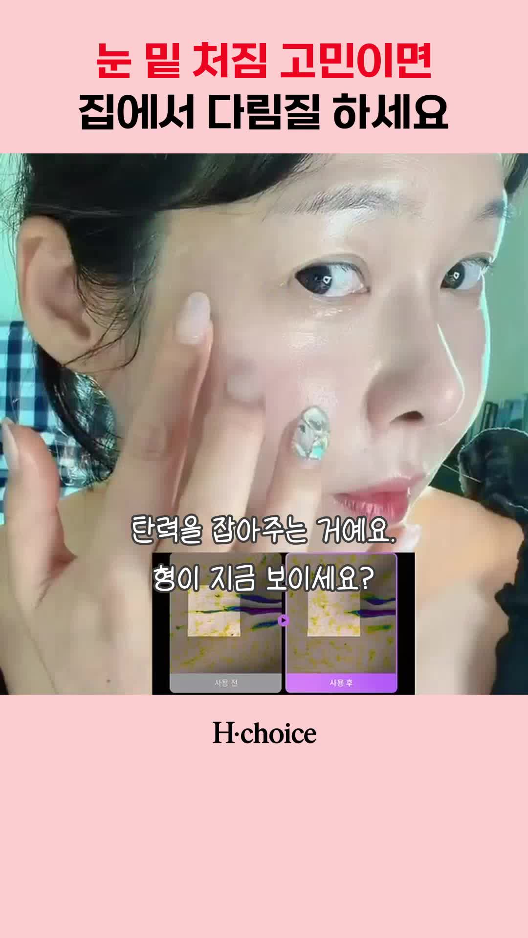 @현영초이스