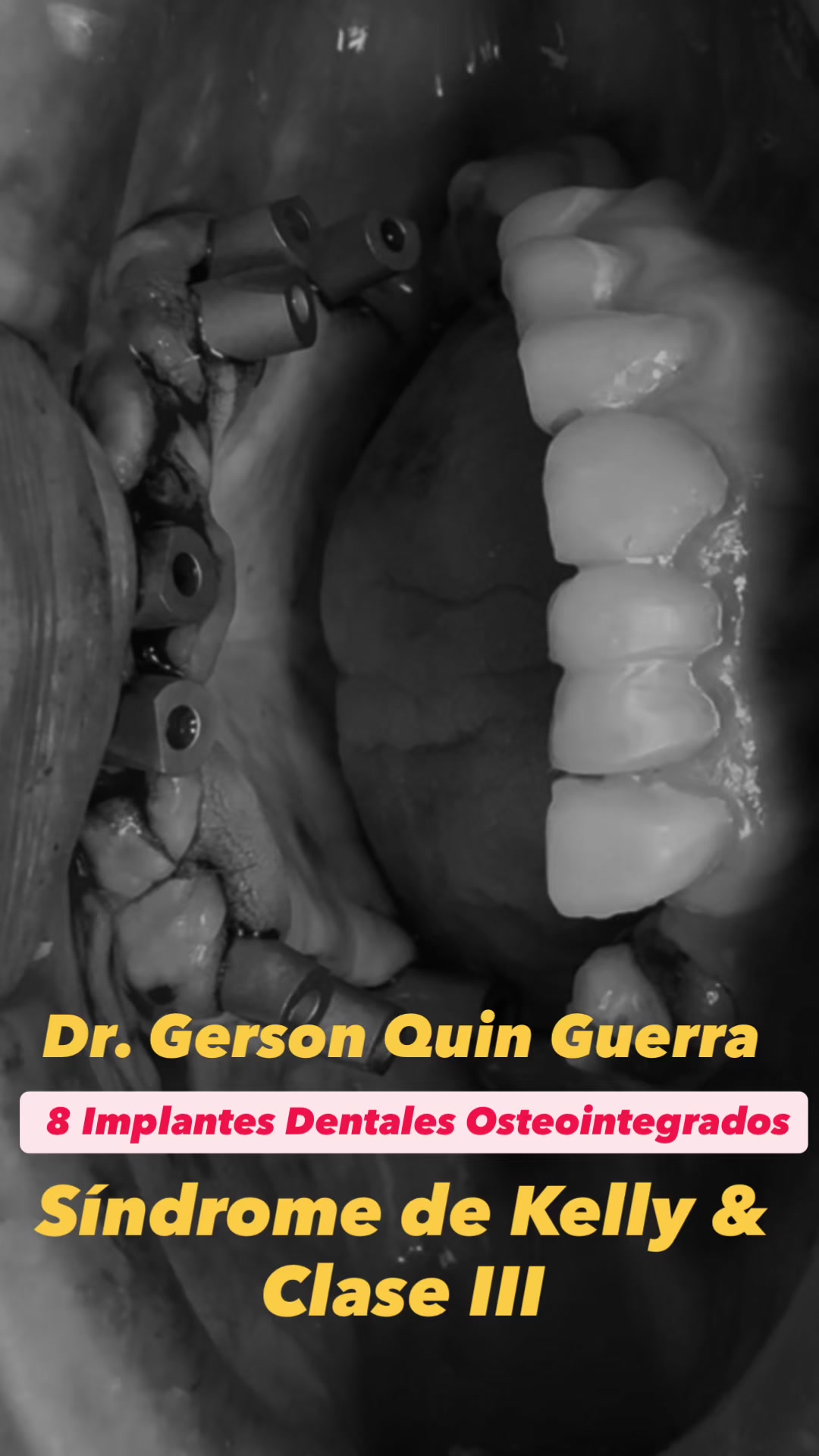 @Dr. Gerson Quin Guerra, PhD