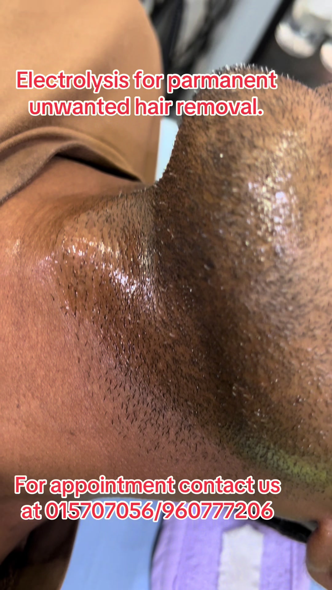 @Dr. Mainali, plastic surgeon