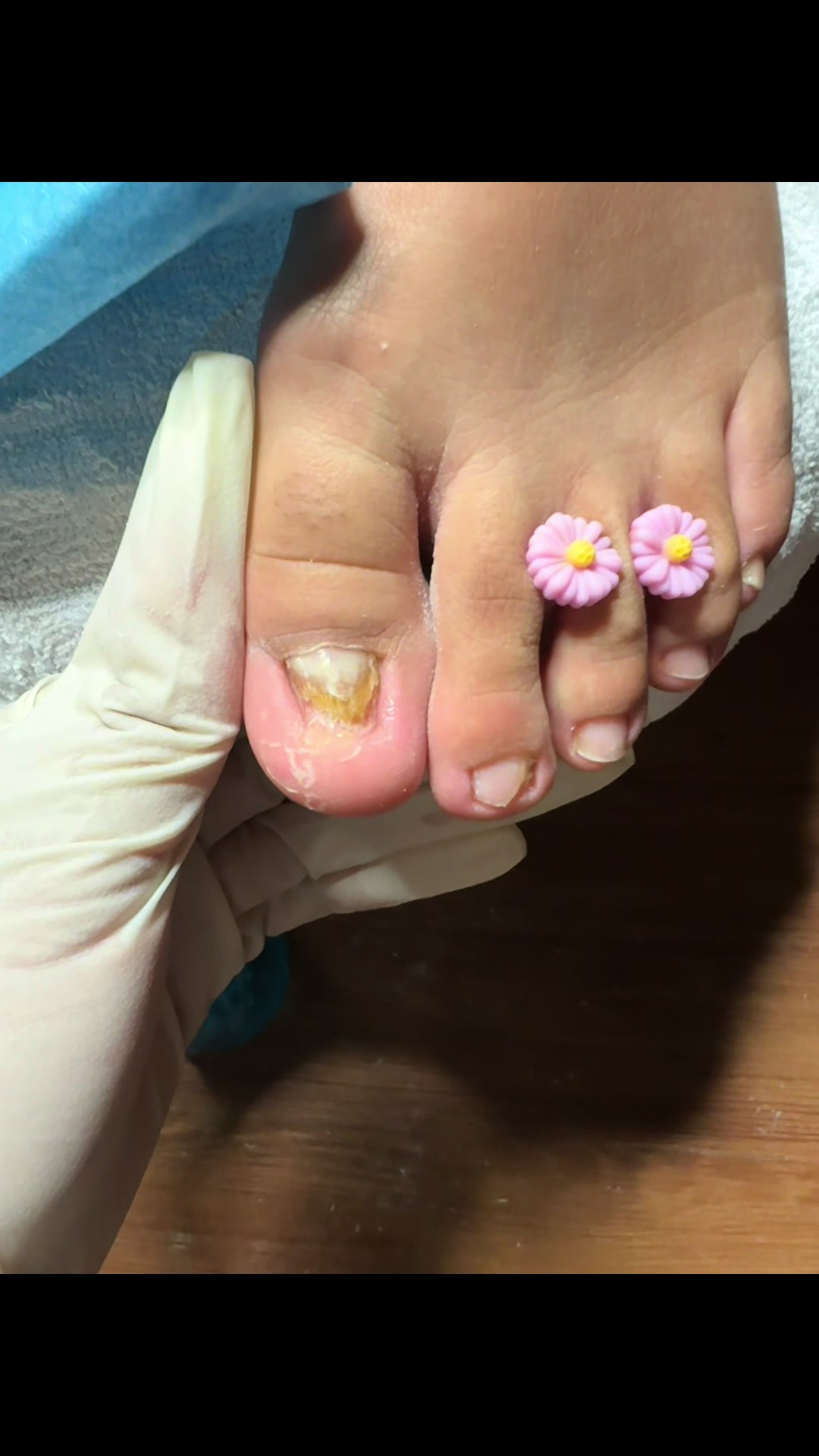 @ToesbyKoki