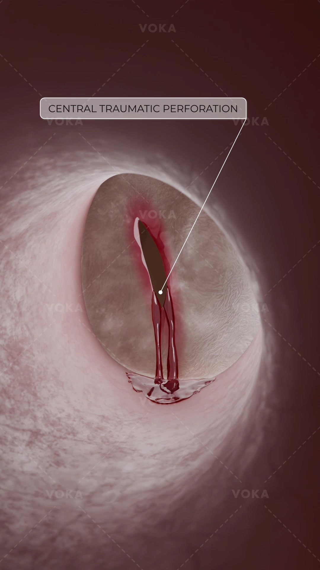 @VOKA 3D Anatomy & Pathology