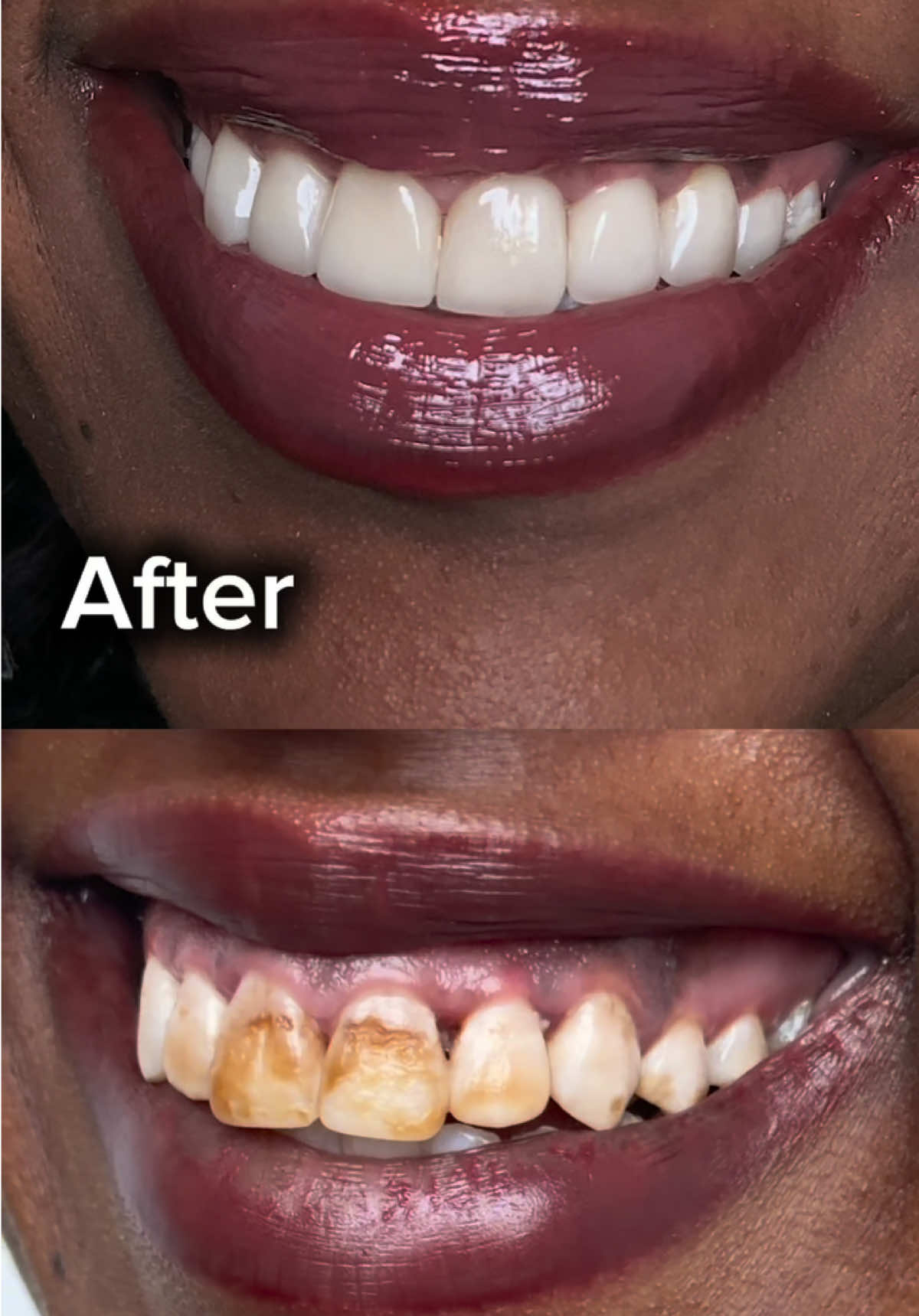 @drhelina_smile_architect