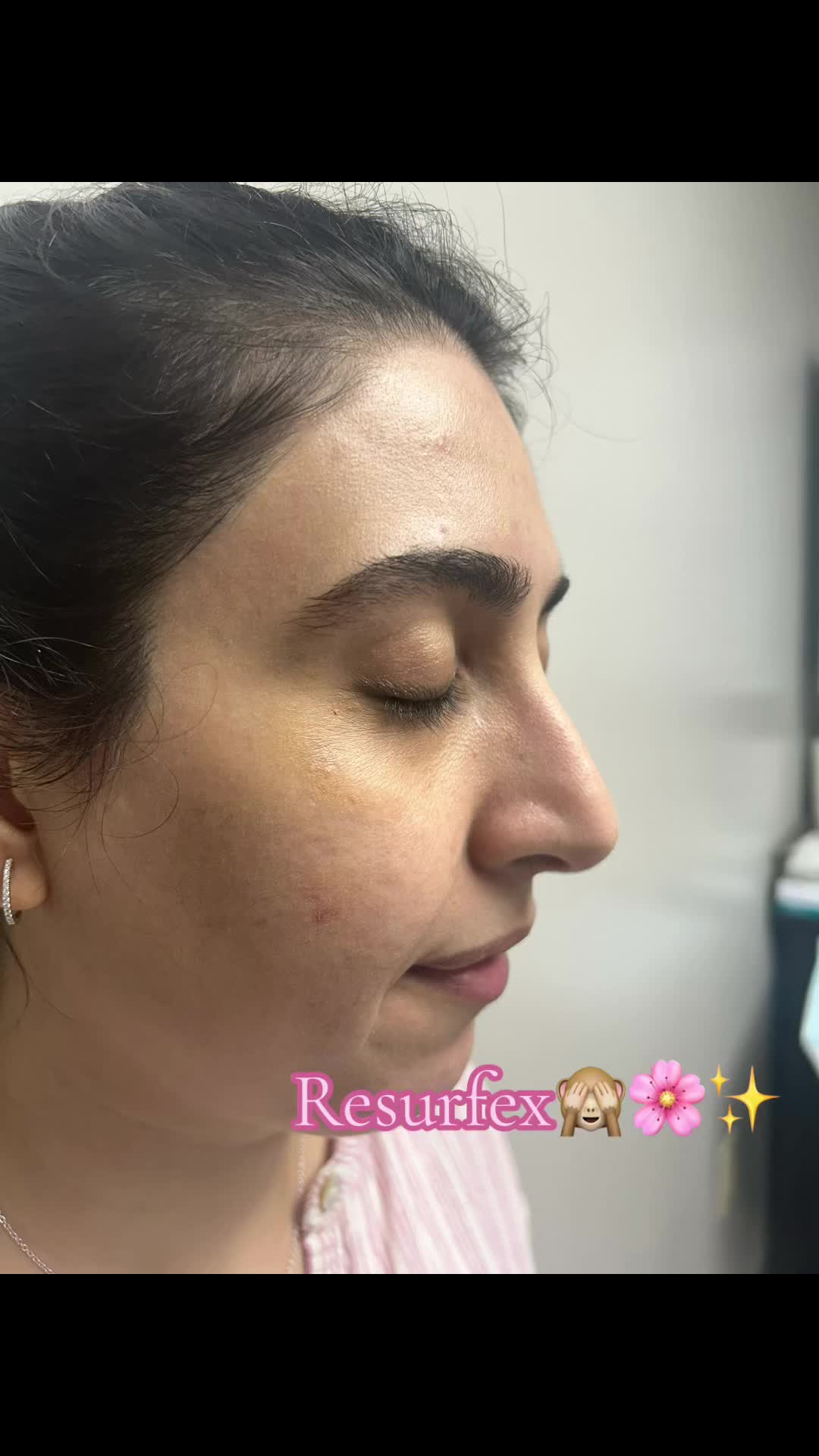 @Beauti4skin MedSpa