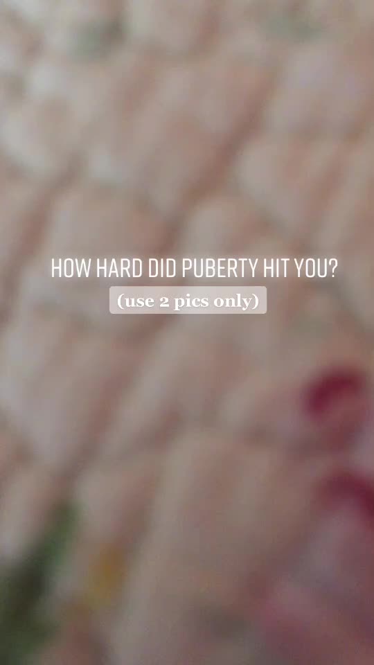 @Luna Cannatella