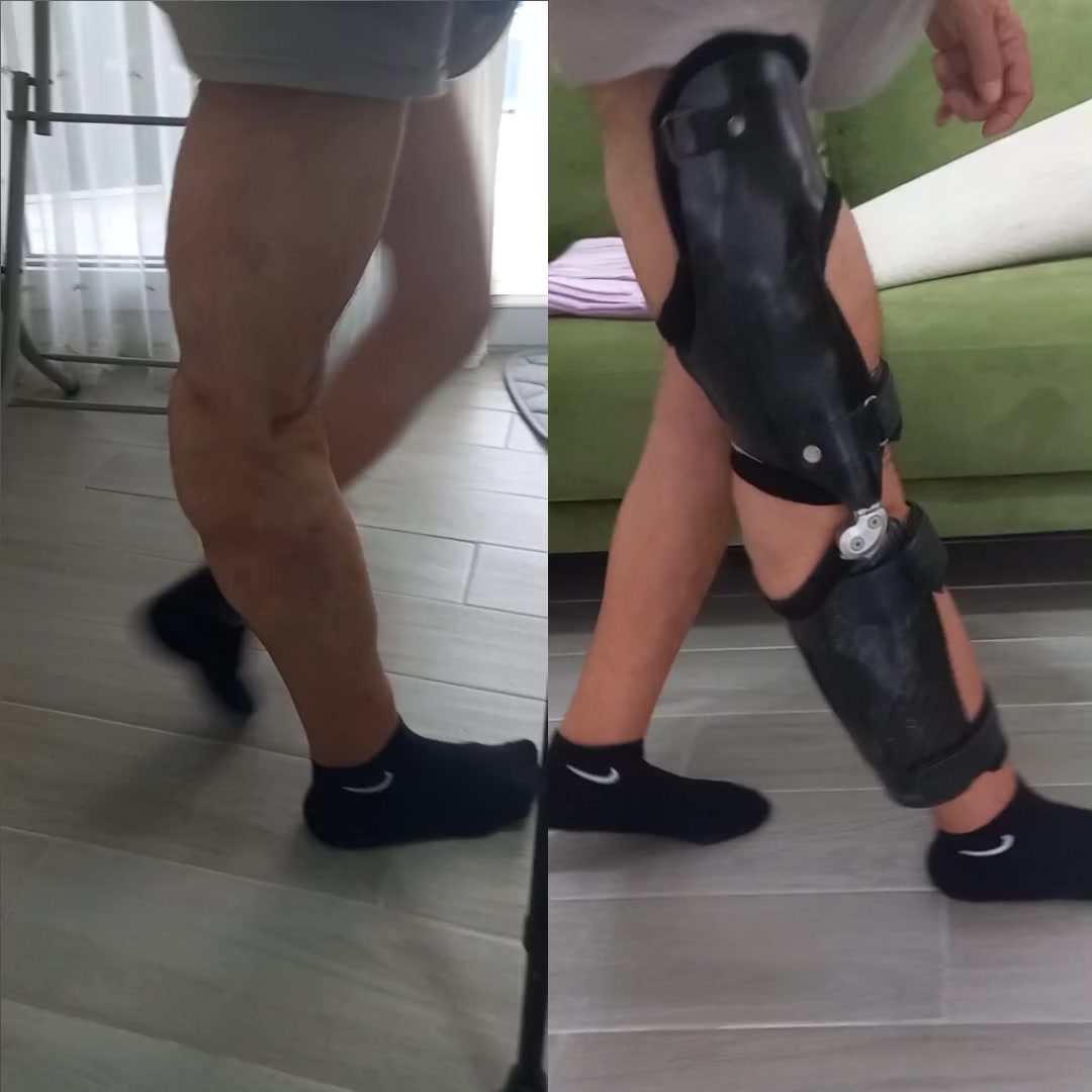 @KanatOrtopedi