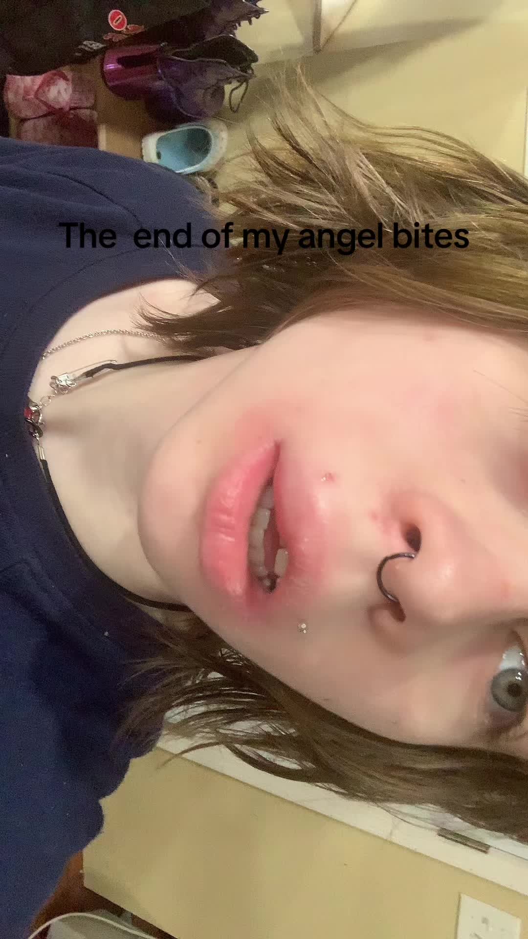 @wethefrogarestonger