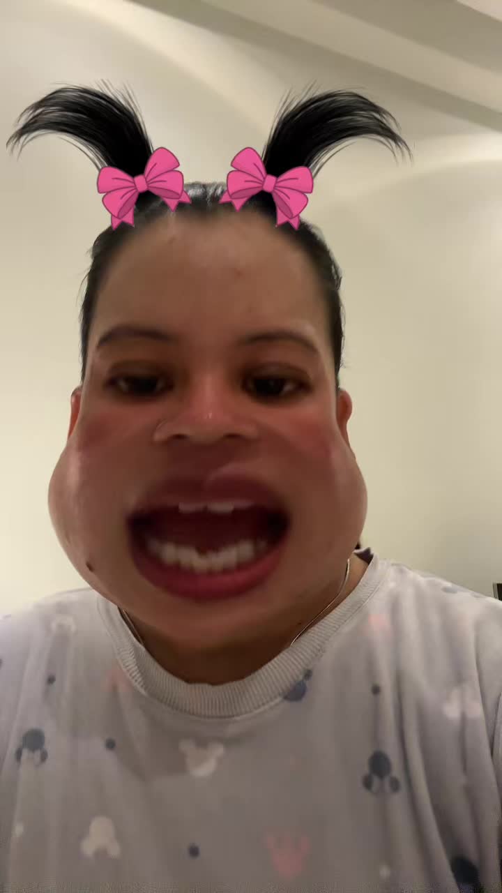 @@$|-|@