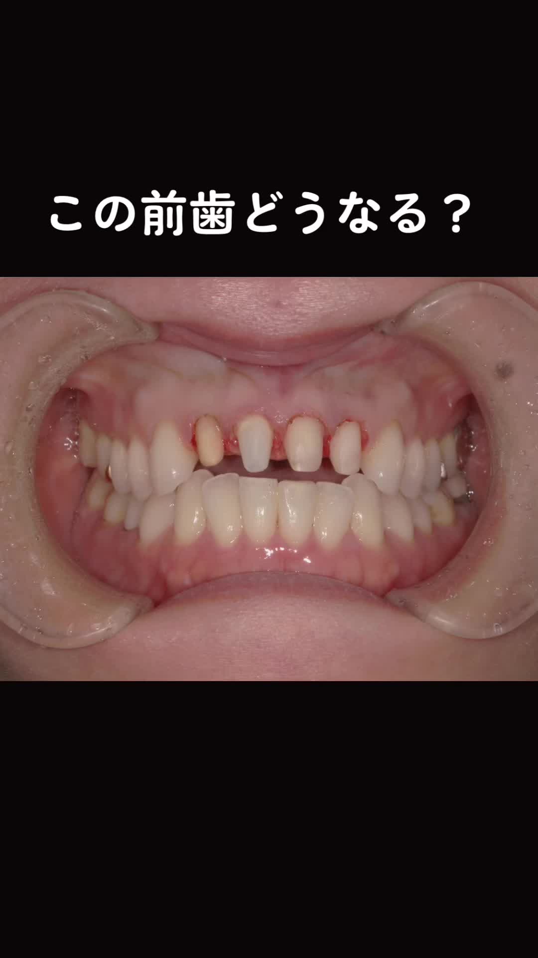 @DentalClinicPURE