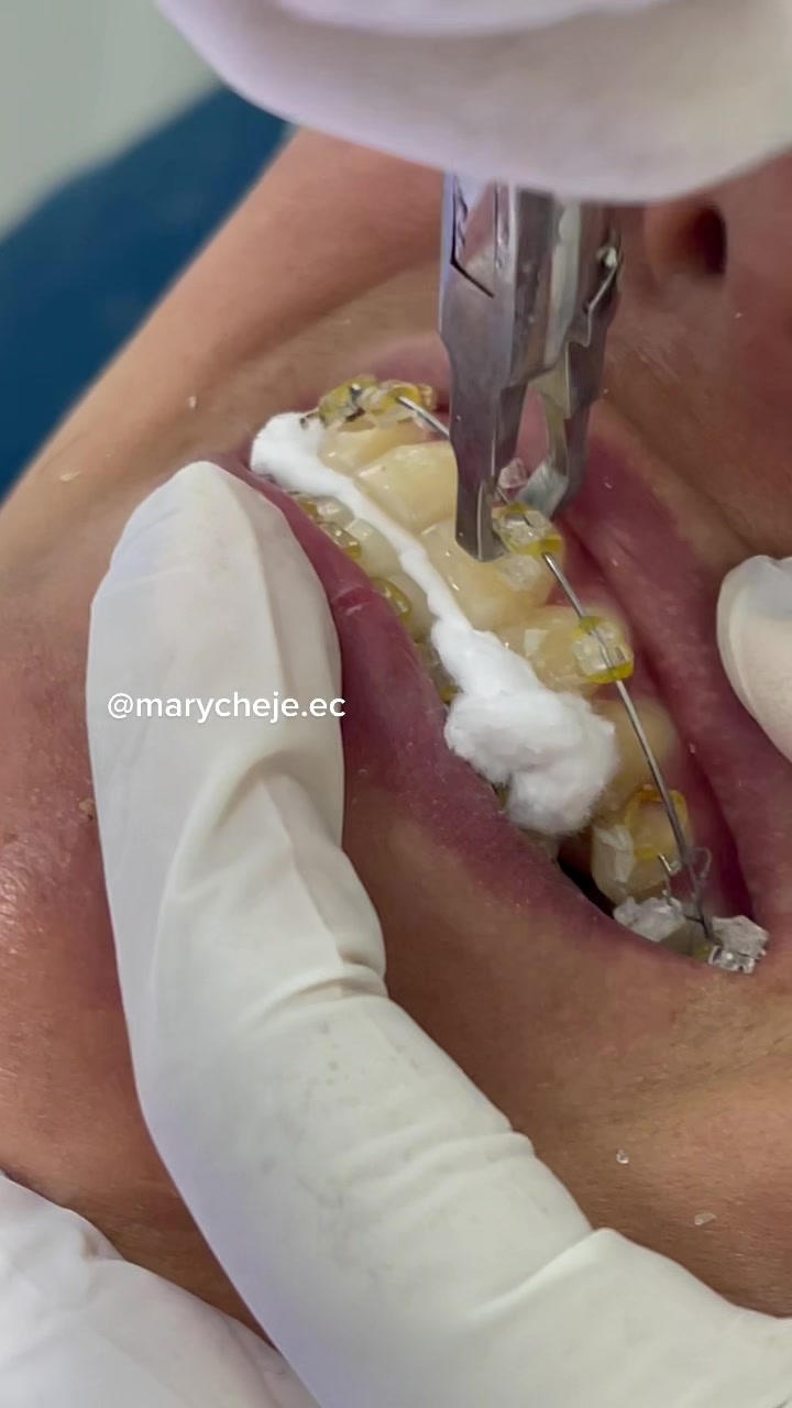 @Od. Marilyn Chejade L. 😷🦷