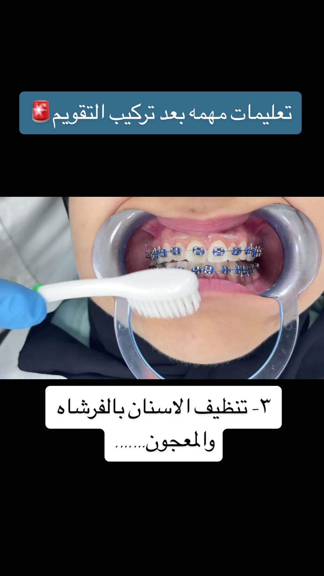 @DR.Tareq Bali