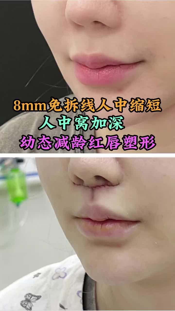 @Dr.HuJunJie