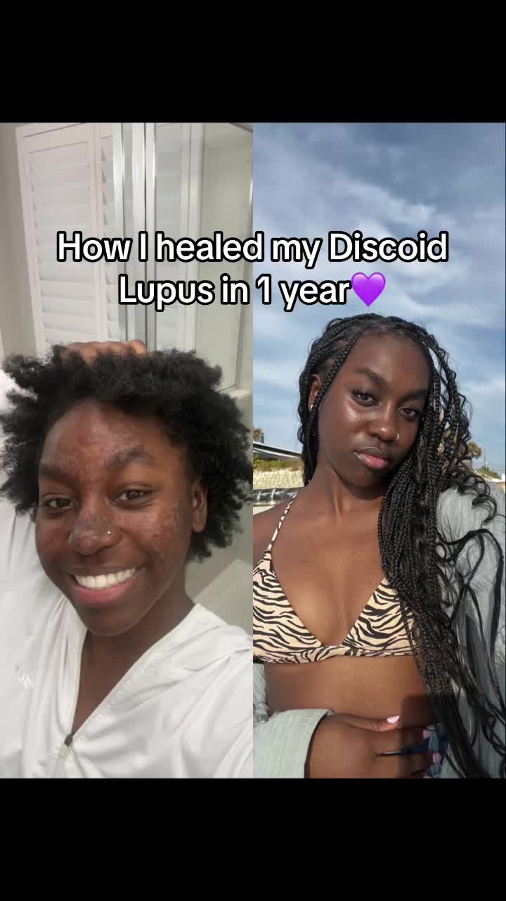 @jeneva | lupus warrior