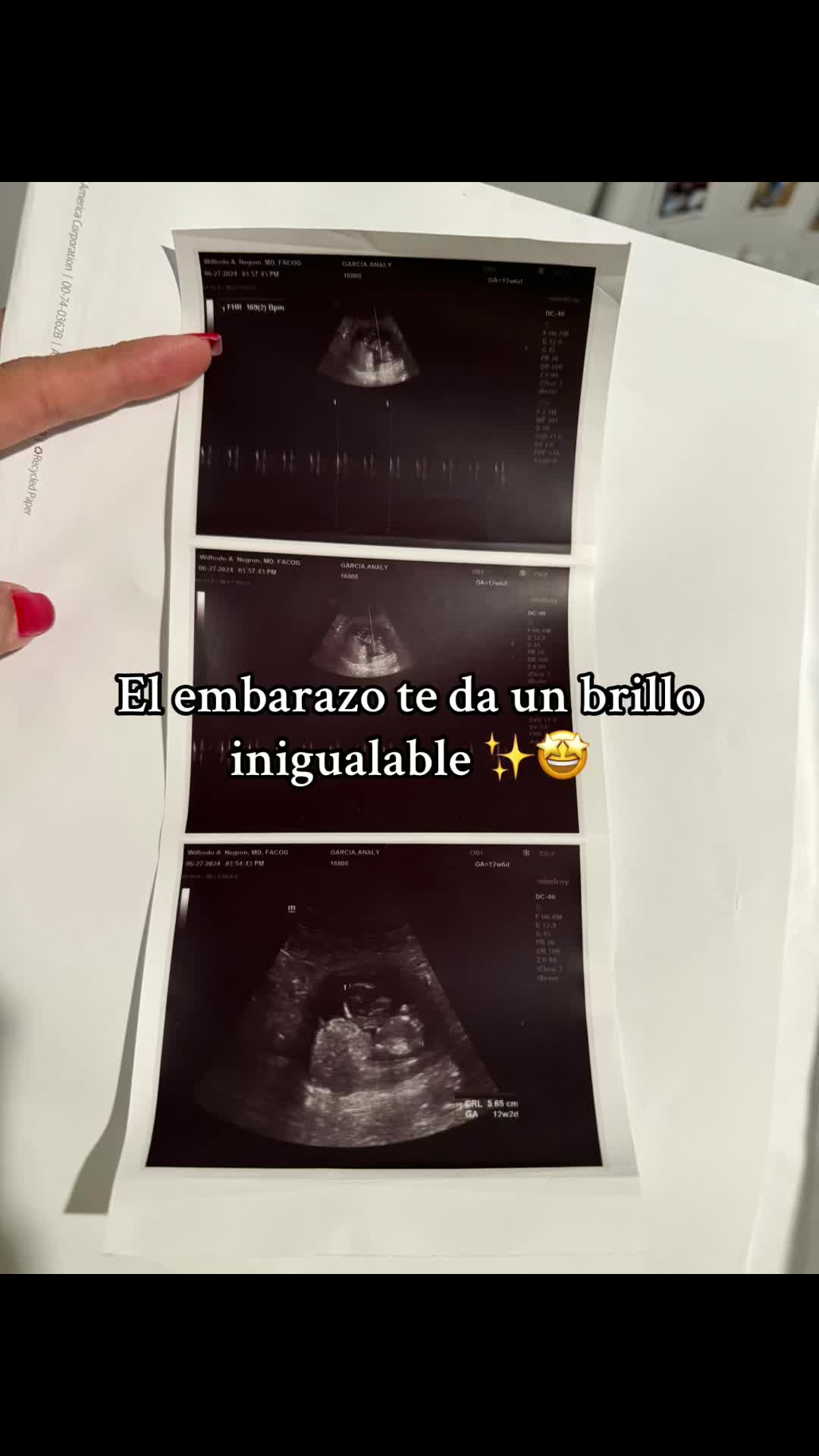 @analy_graciela23