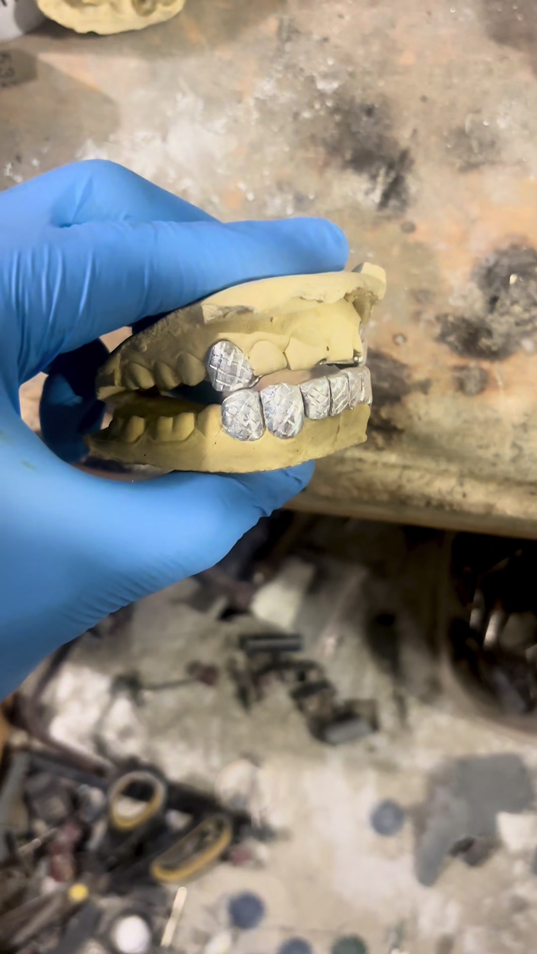 @Flawless Grillz