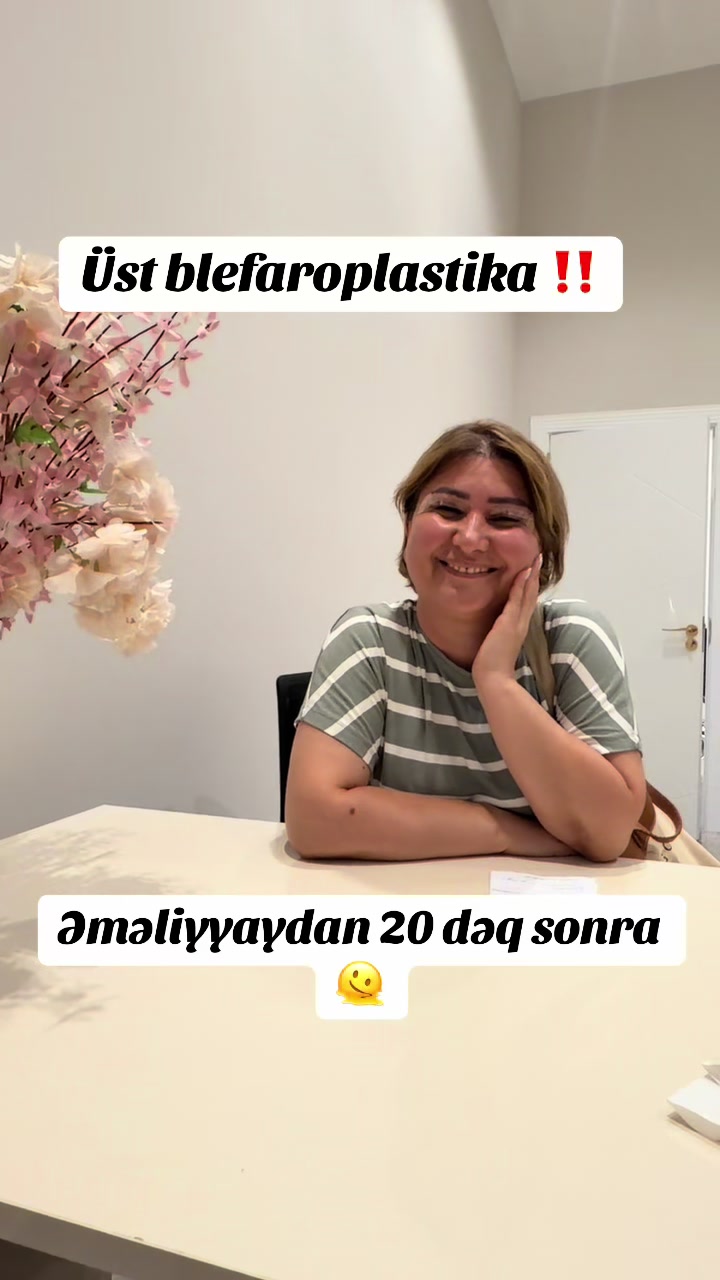 @Dr.ataxanli