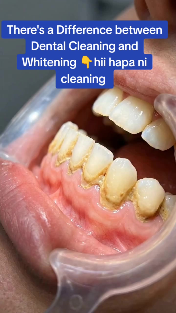 @MIRAHN DENTAL CARE