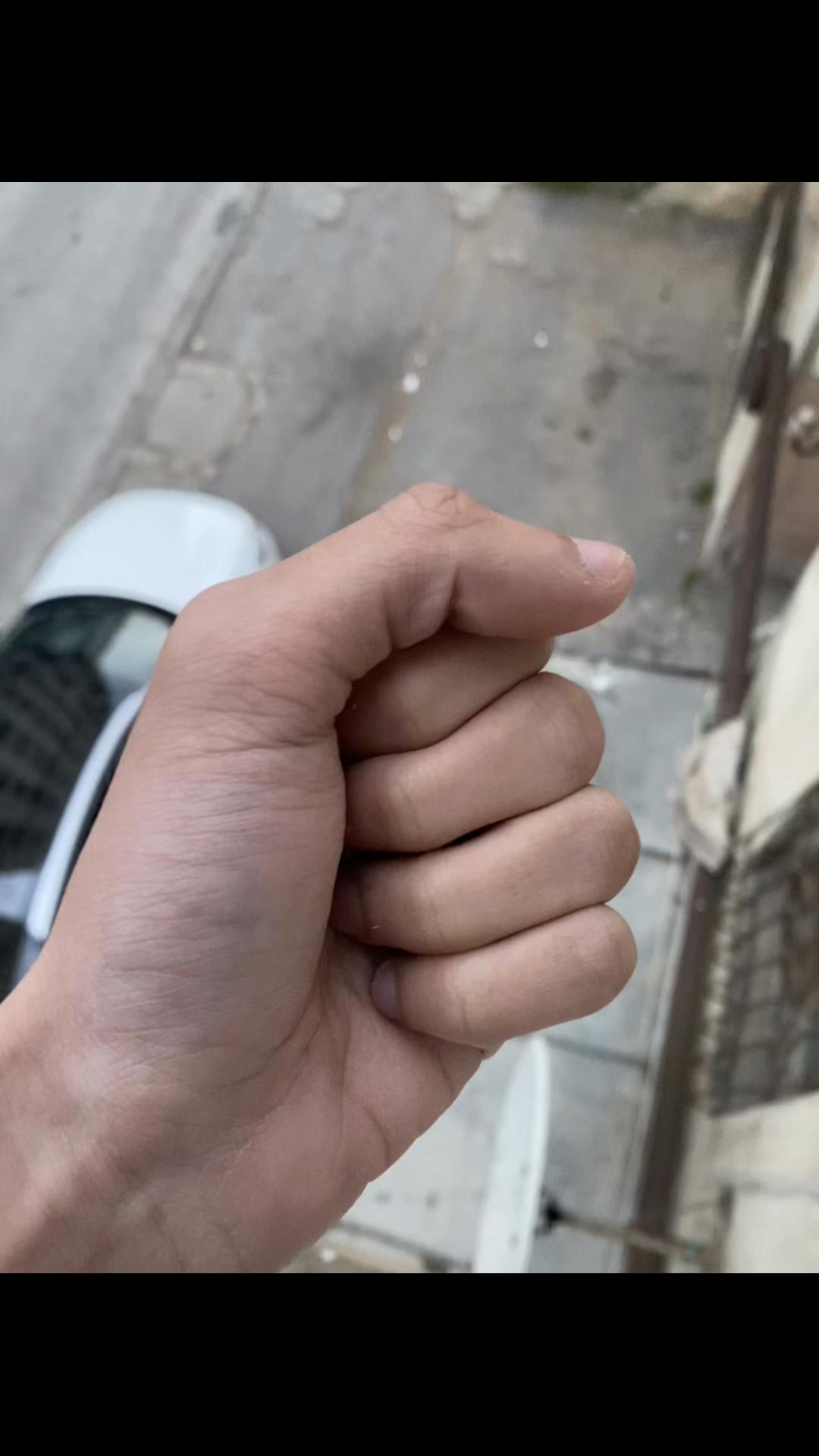 @𝟏𝟕