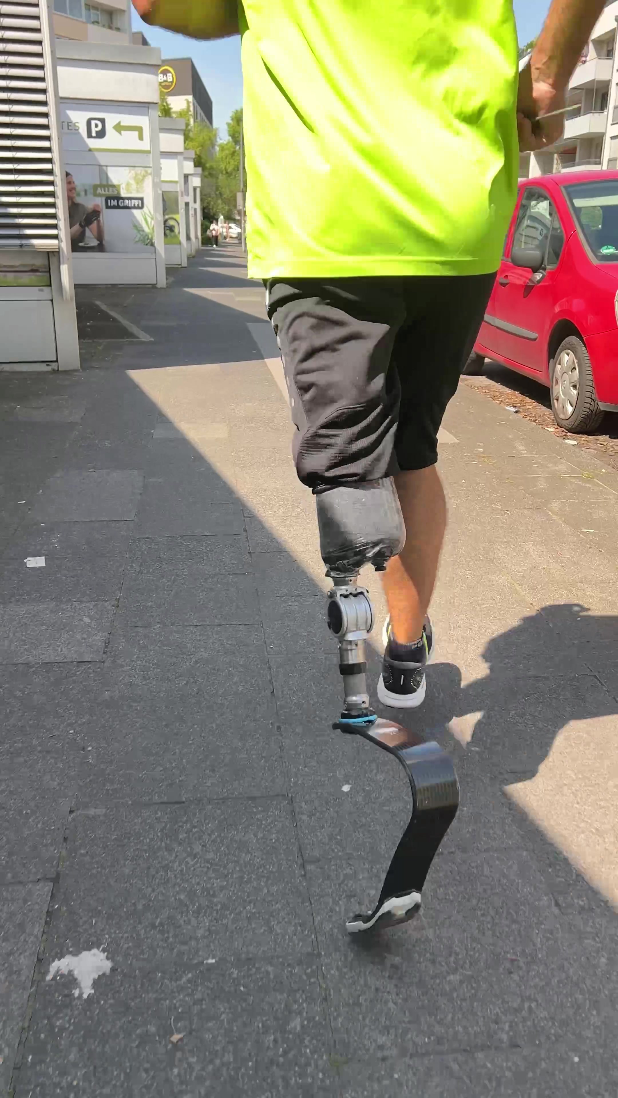 @Lentes Prothesenwerkstatt
