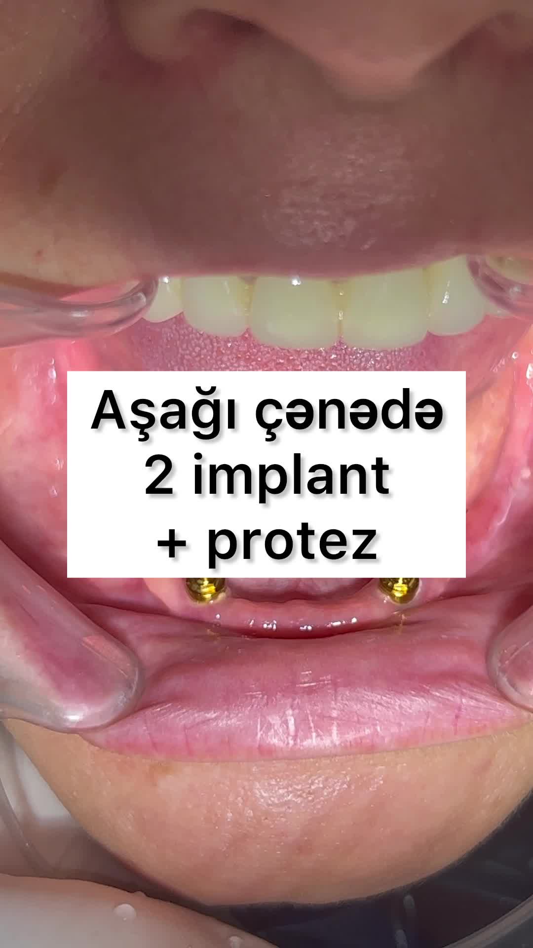@eltakindentistry