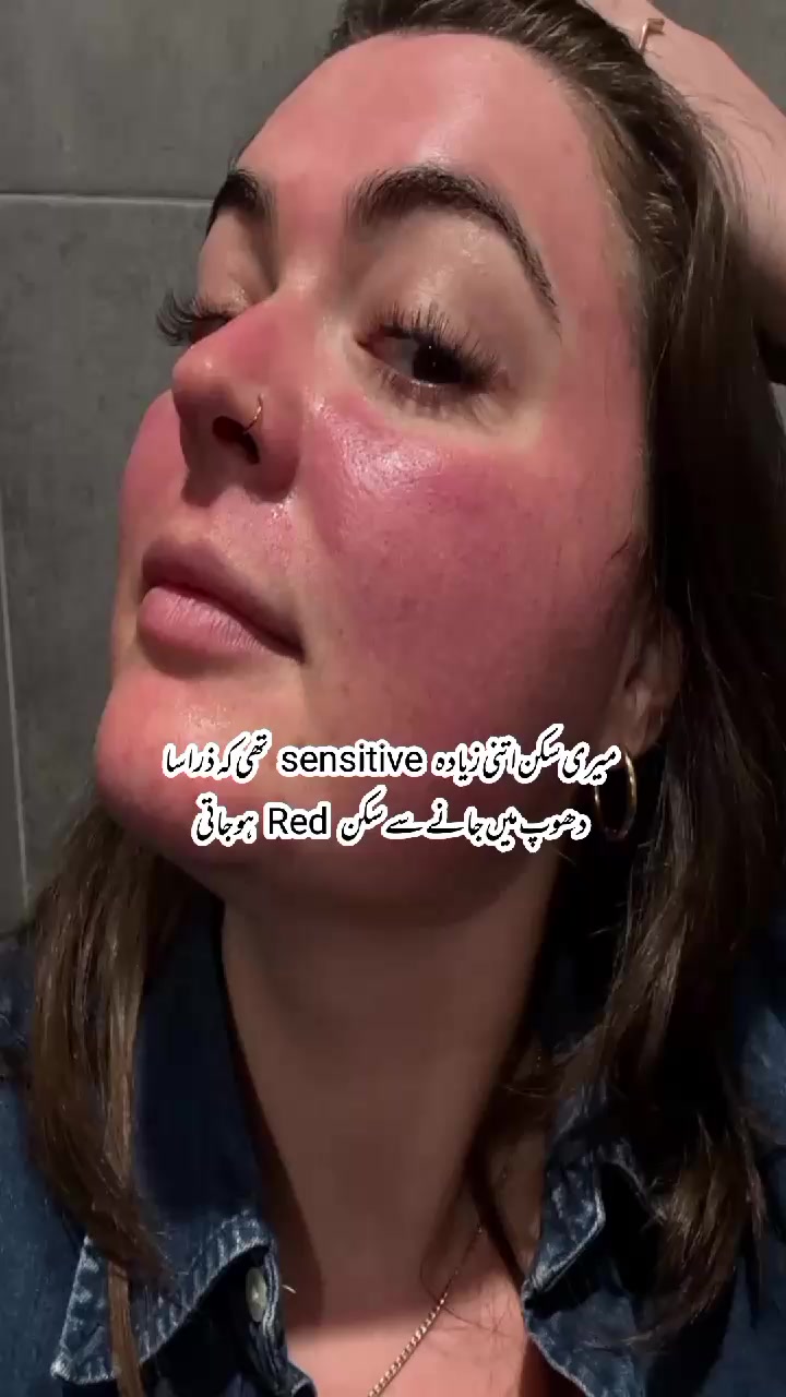 @✨𝗦𝗸𝗶𝗻𝗖𝗮𝗿𝗲_𝗤𝘂𝗲𝗲𝗻✨