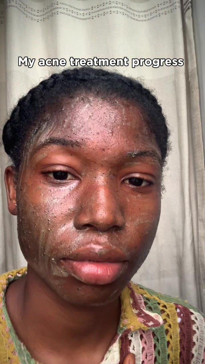 @Jhoi