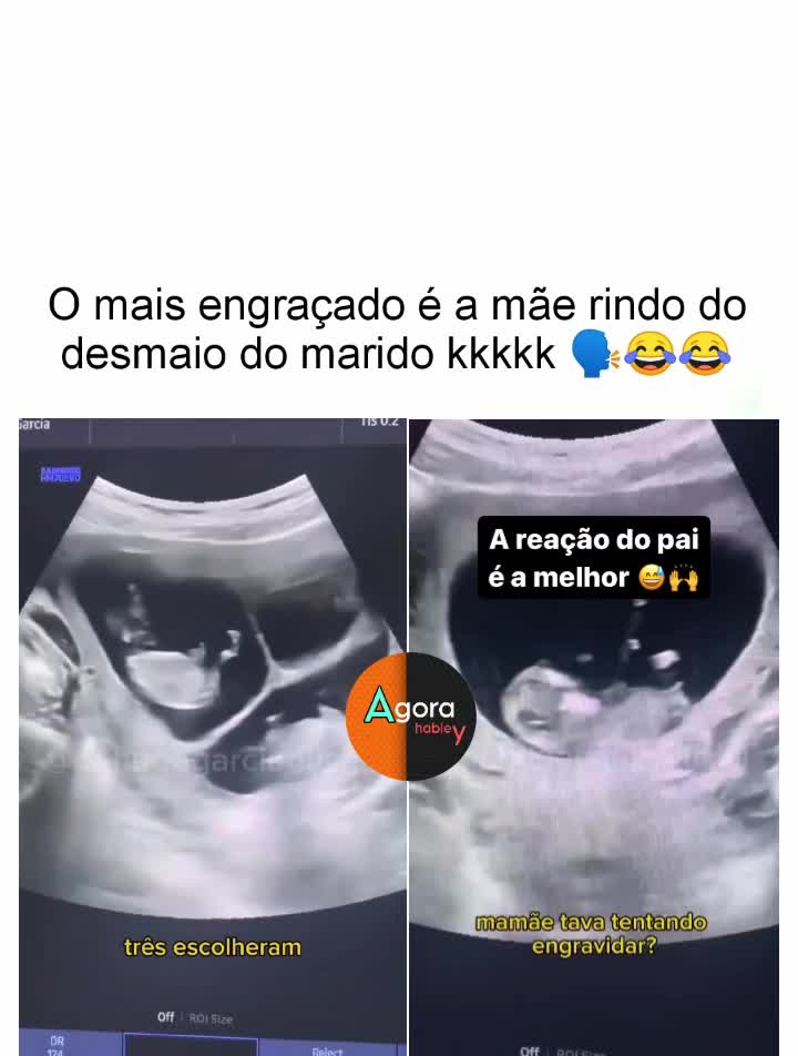 @Agora habley