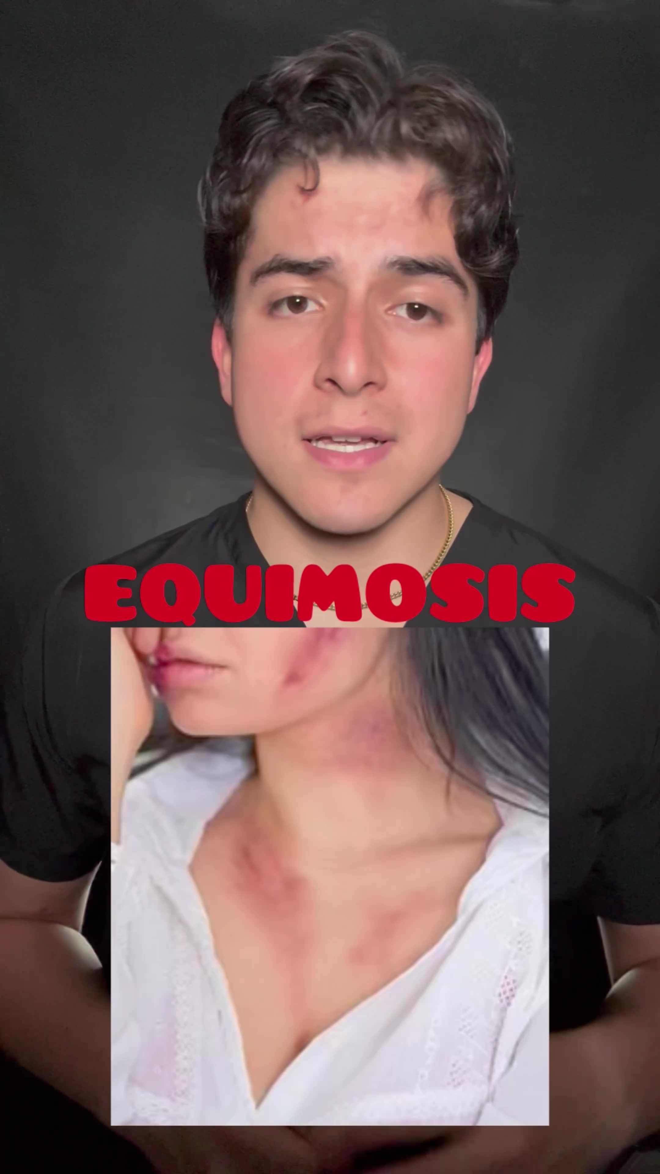 @Lalo Villalobos