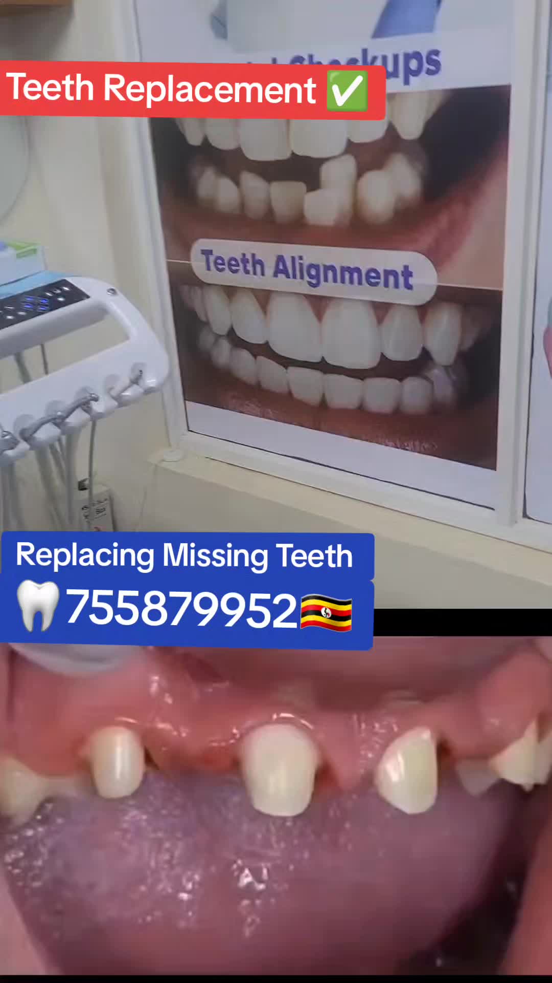 @Allianz Dental studio🦷🦷🇺🇬