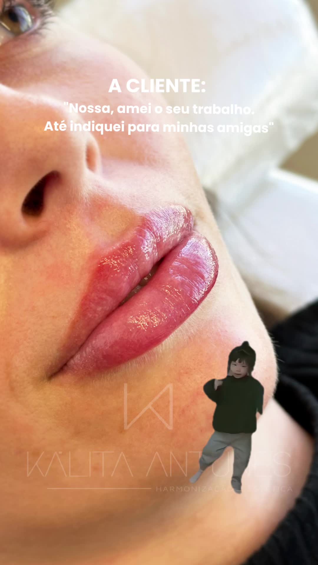 @drakalitaantunes