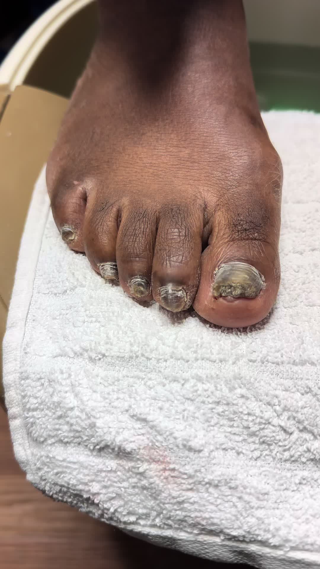 @ToesbyKoki
