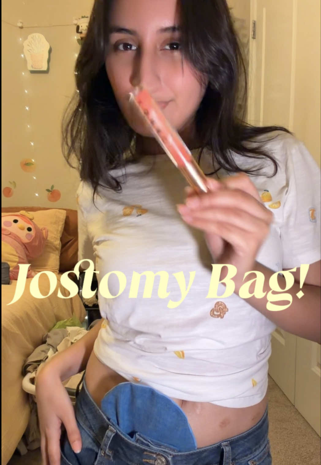 @ostomate