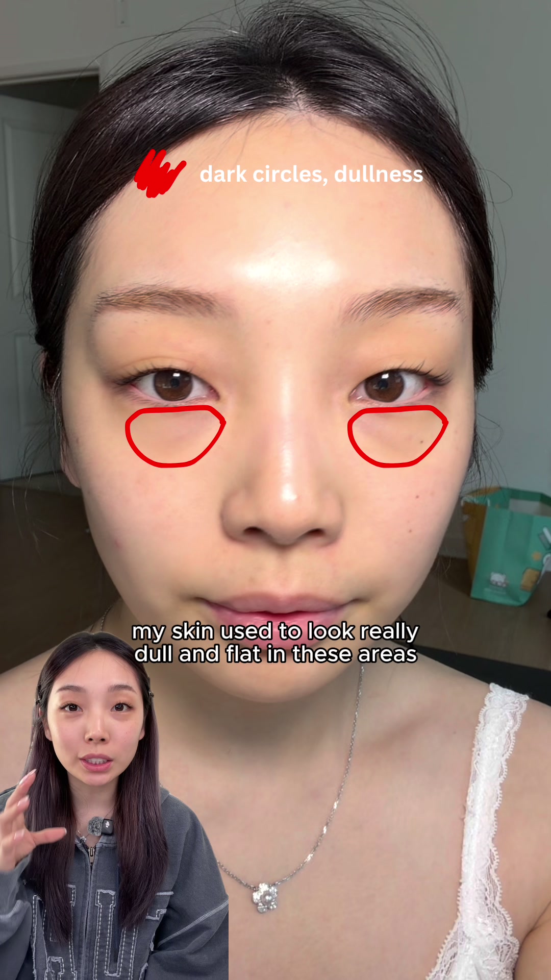 @lily
