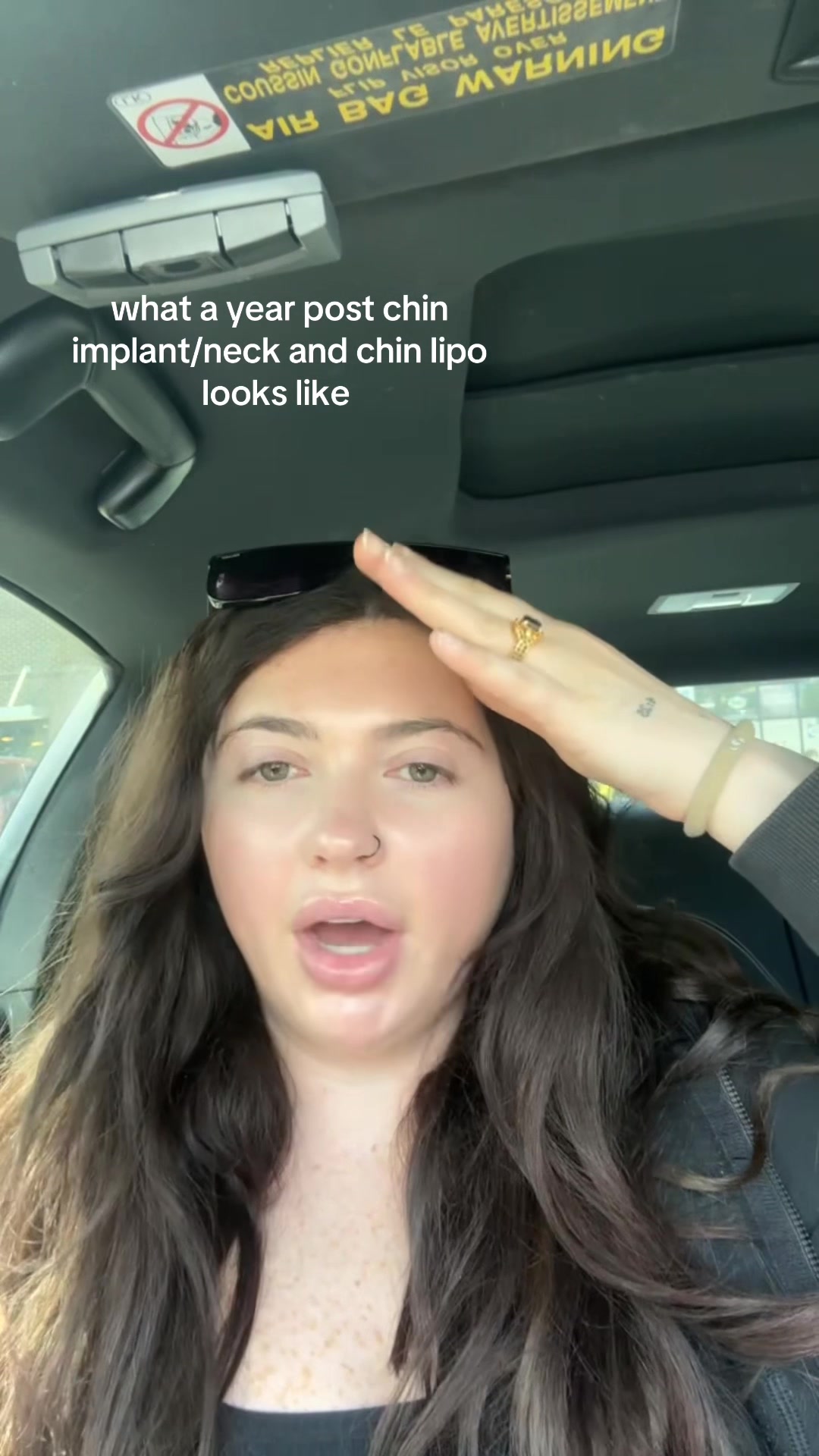 @ABBY OYSTER | NASH SKIN GURU