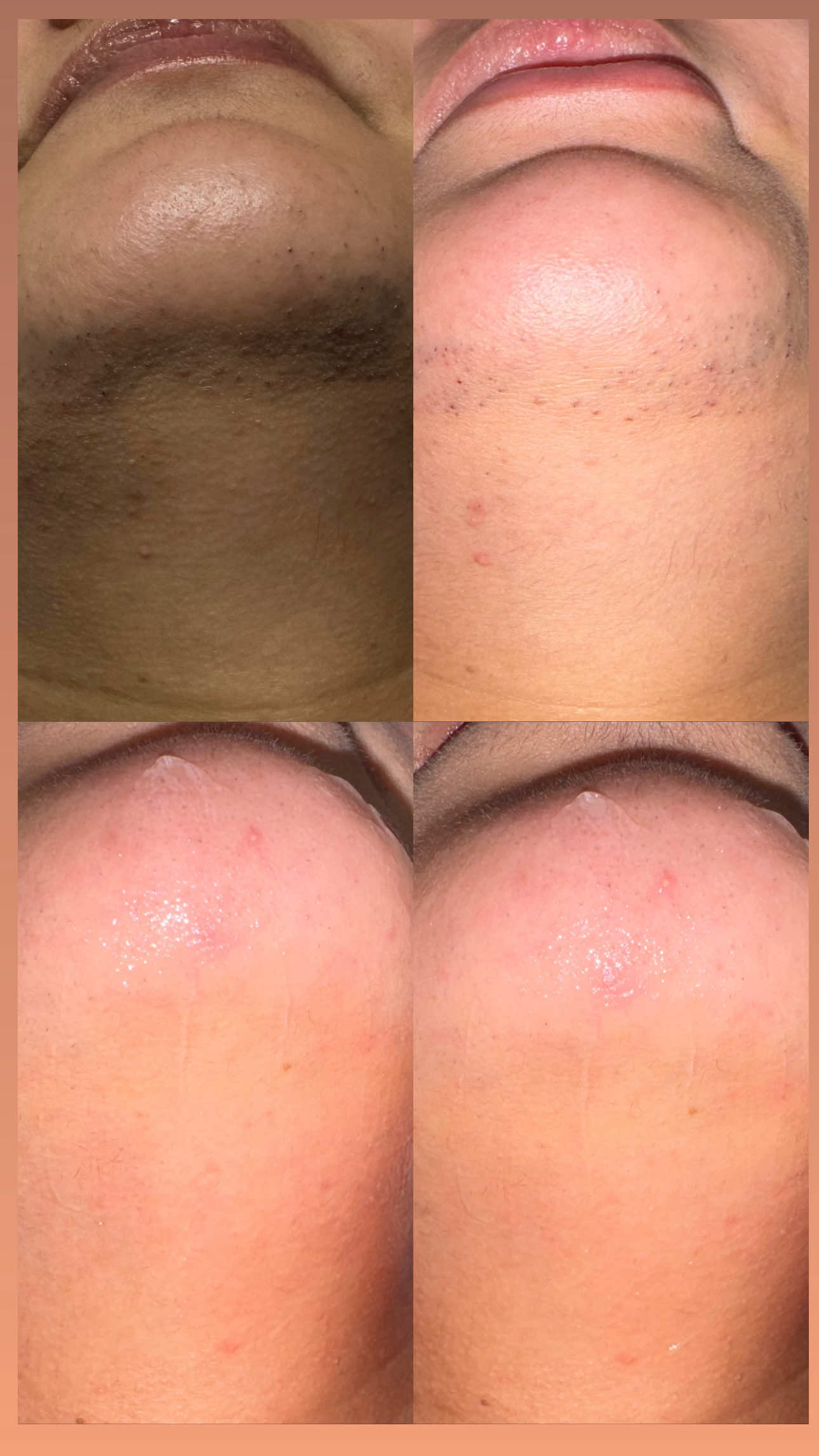 @ARY SECRET SPA
