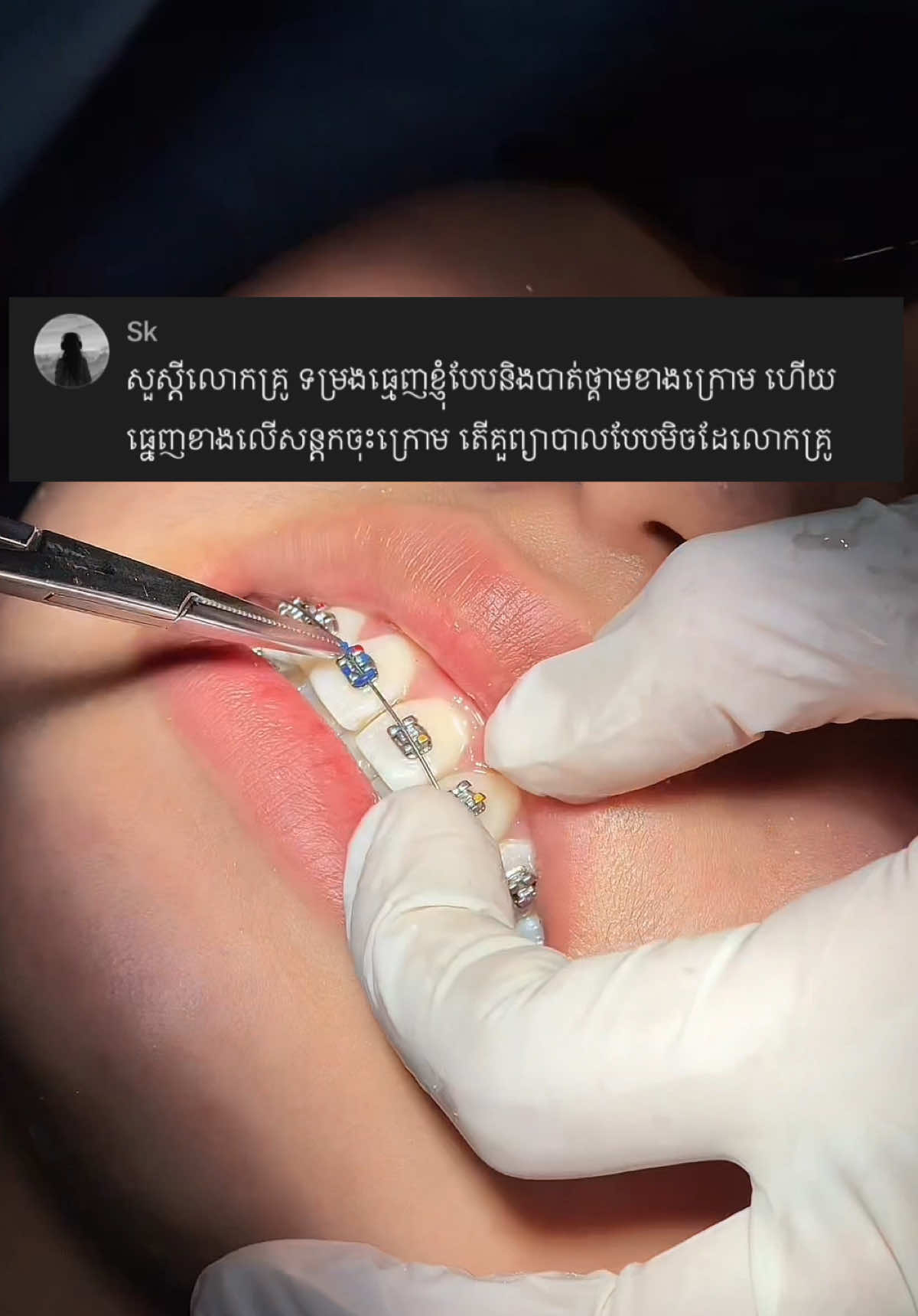 @BRIGHT SMILE DENTAL HOSPITAL