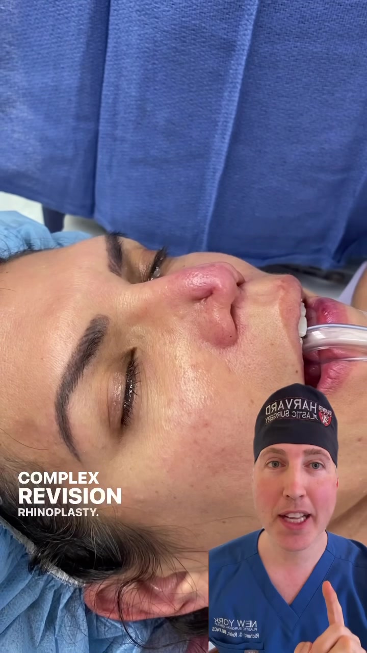 @Dr. Richard Reish, M.D., FACS