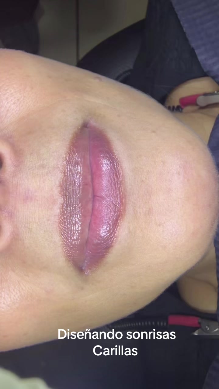 @DrAlejandro Carrillo