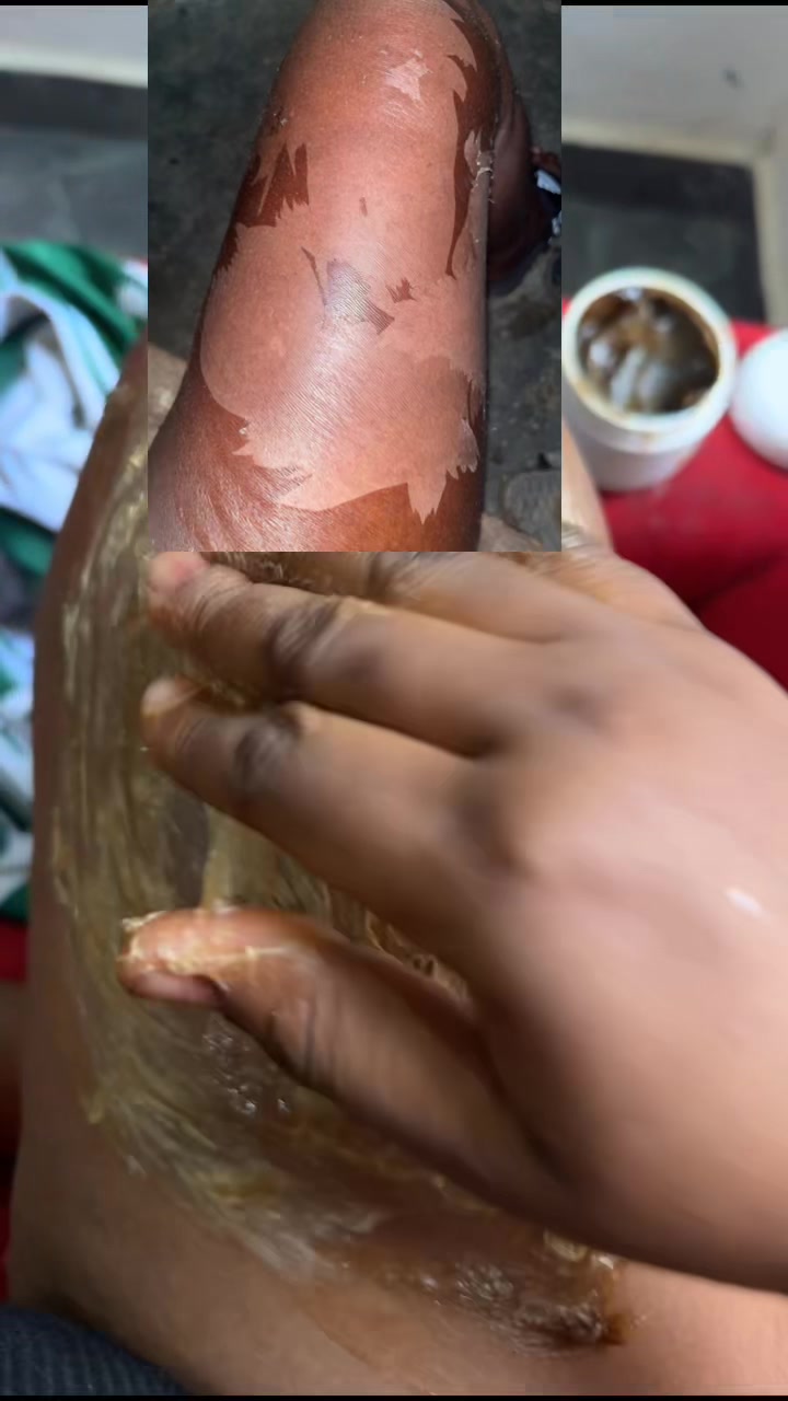 @@ Precious peeling soap