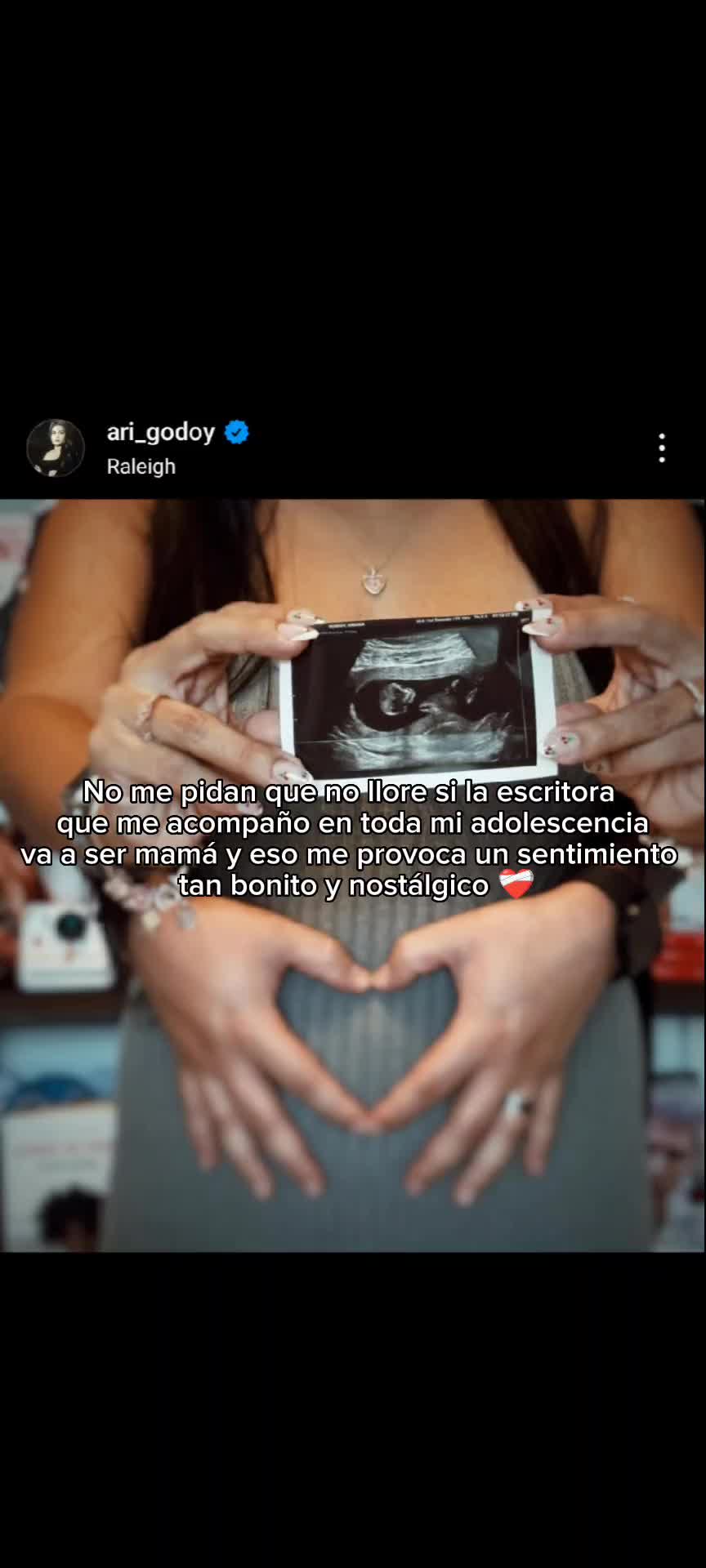 @La sonrisa de Jongin
