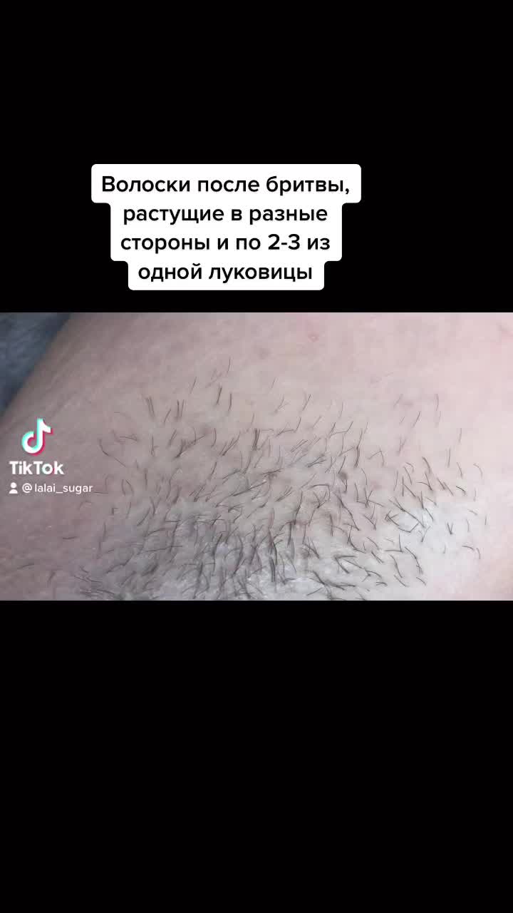 @Шугаринг Сергиев Посад