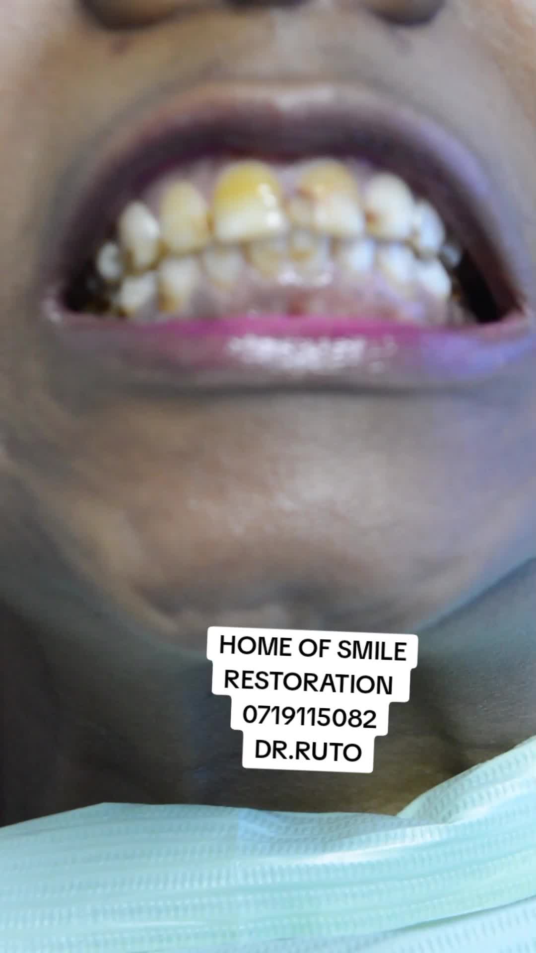 @THE SMILEY DENTAL KE