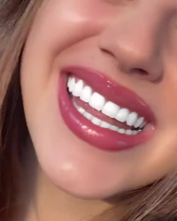 @Dr_sheraz_official 🦷