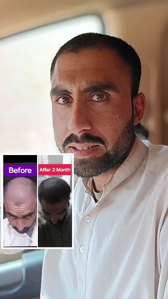 @Farooqui Lotion
