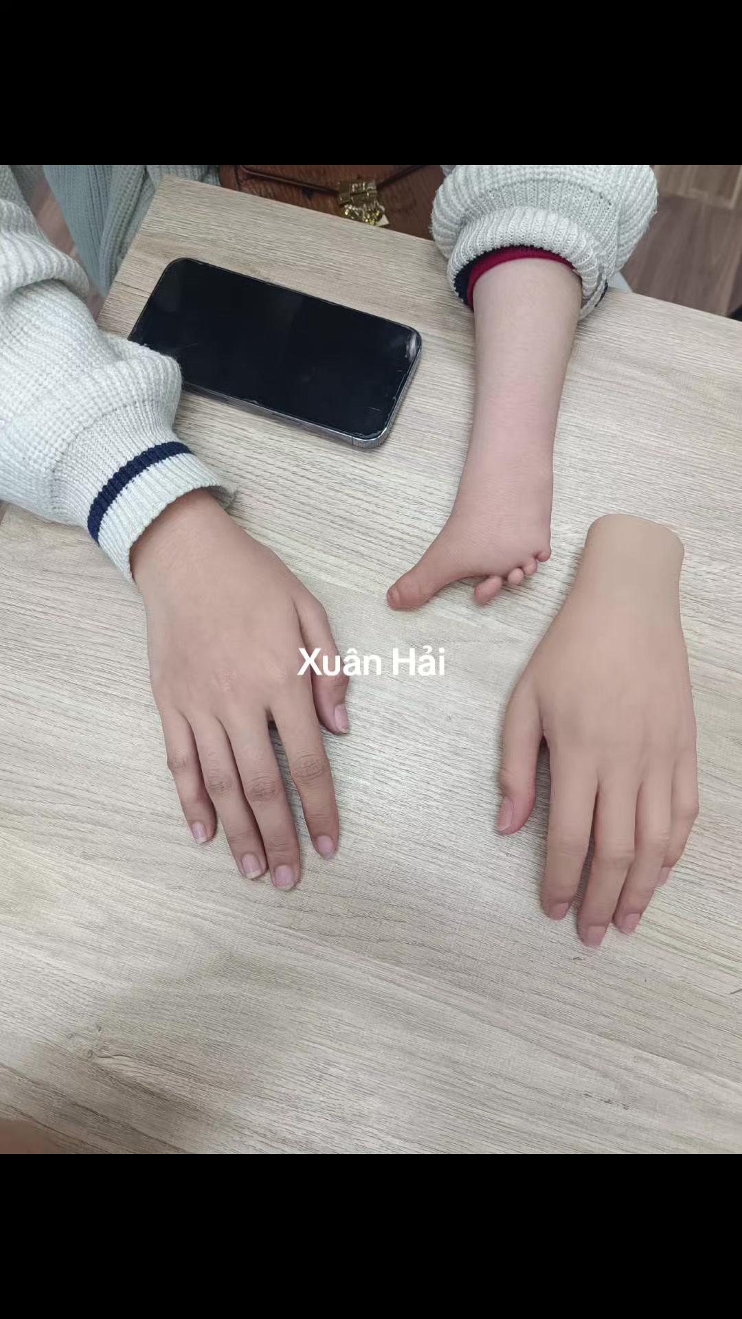 @Hải R&acirc;u Tay Ch&acirc;n Giả