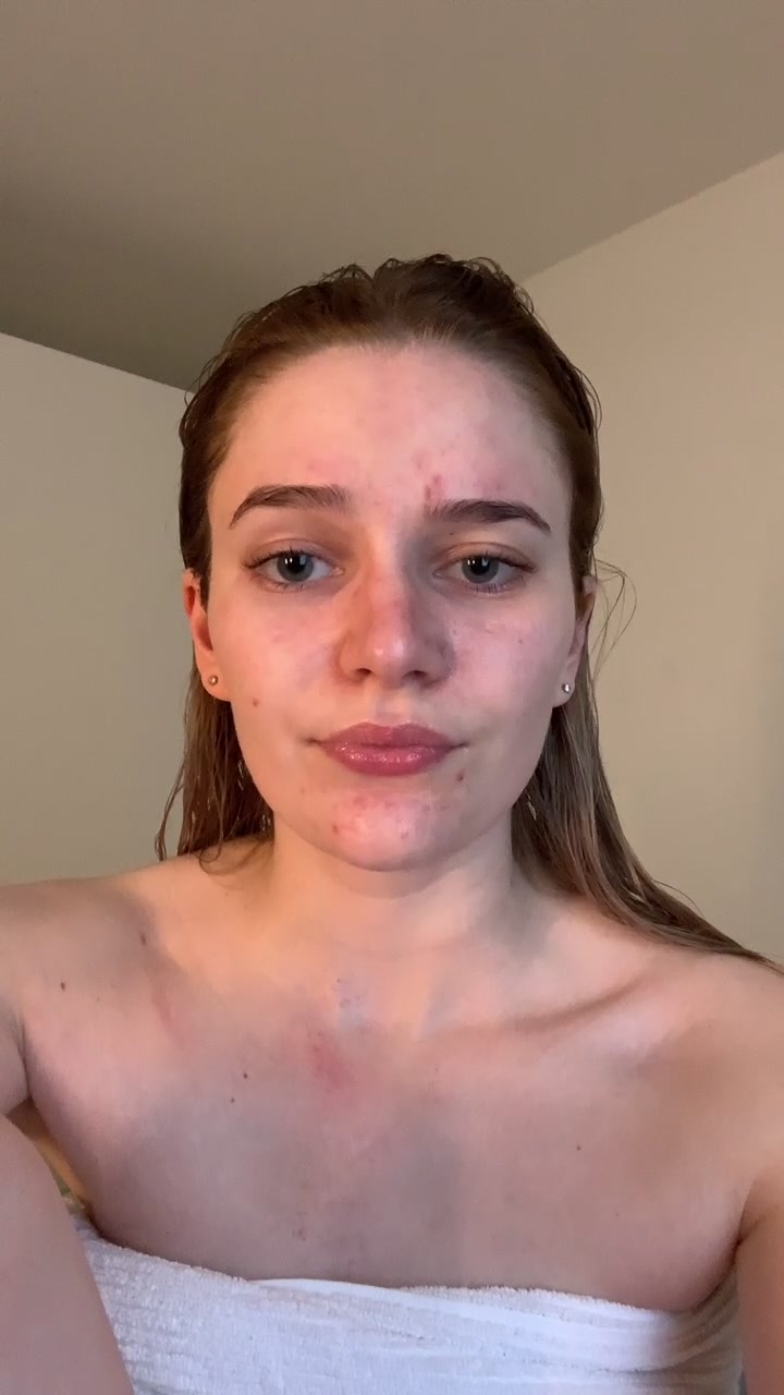 @anne.klara