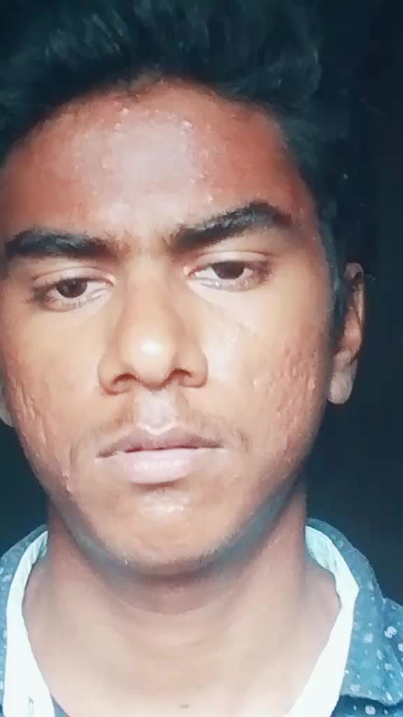 @Ajay kp