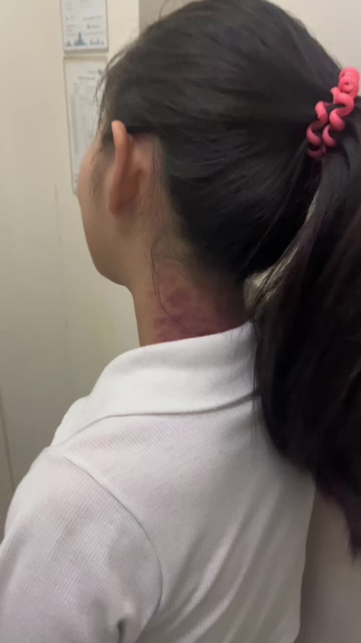 @Mexiyou